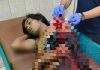 Pasca Penjaga Ternak Dibacok, Dua Kelompok Pemuda Nyaris Terlibat Bentrokan